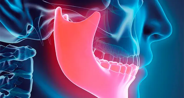 radiografía de mandíbula con maxilar inferior resaltado en rojo